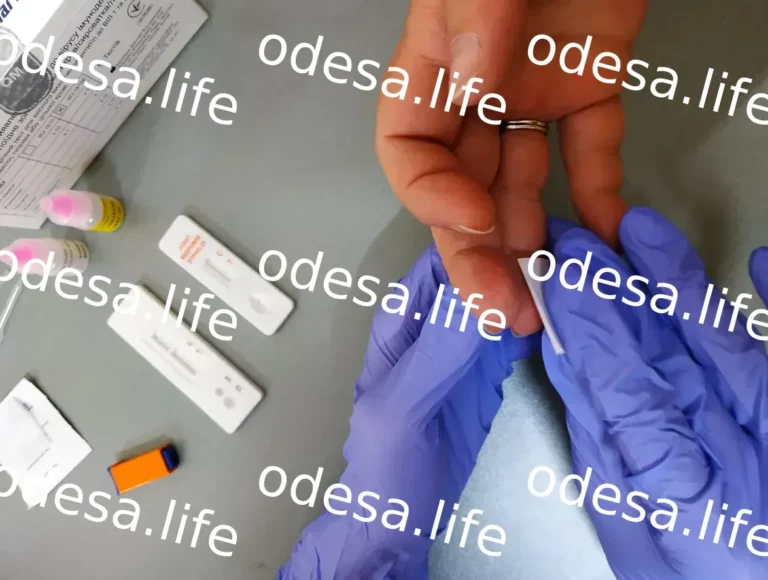 Безкоштовне тестування на гепатити та ВІЛ в Одесі та області